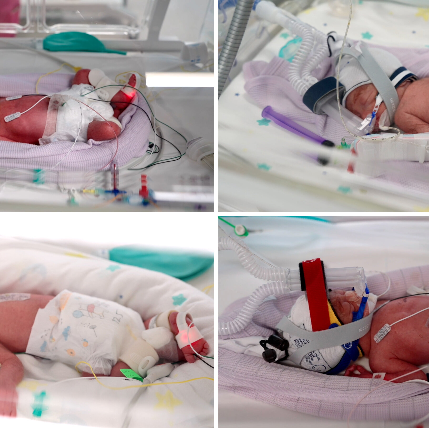 Australian Woman Delivers Extremely Rare Identical Quadruplets Conceived Naturally